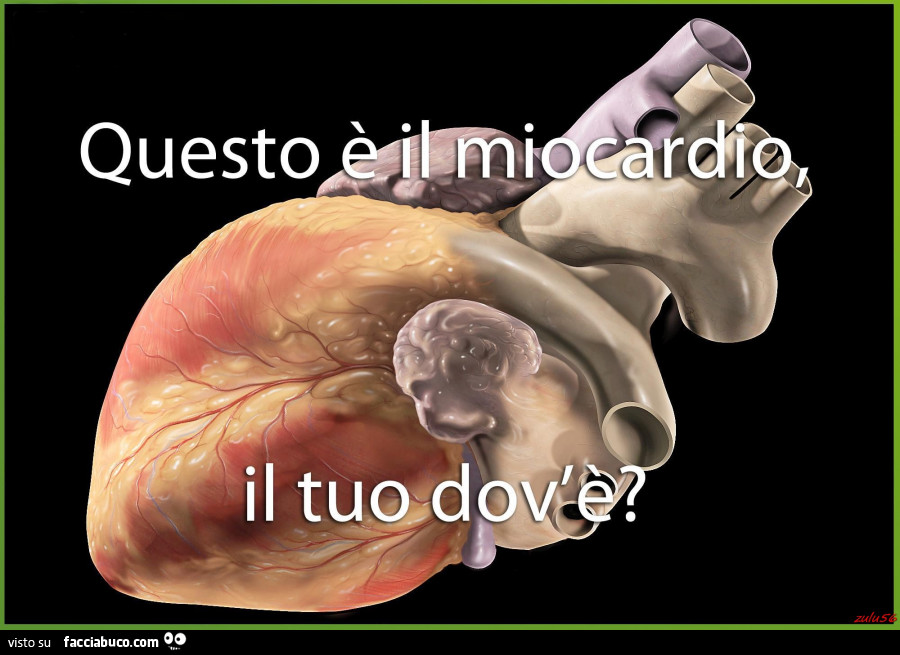 Questo è il miocardio, il tuo dov'è?